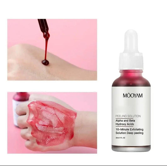 AHA 30% + BHA 2% Peeling Solution 30ml/1oz, Exfoliating Facial Serum, Chemical Peel For Face Serum Glycolic Acid