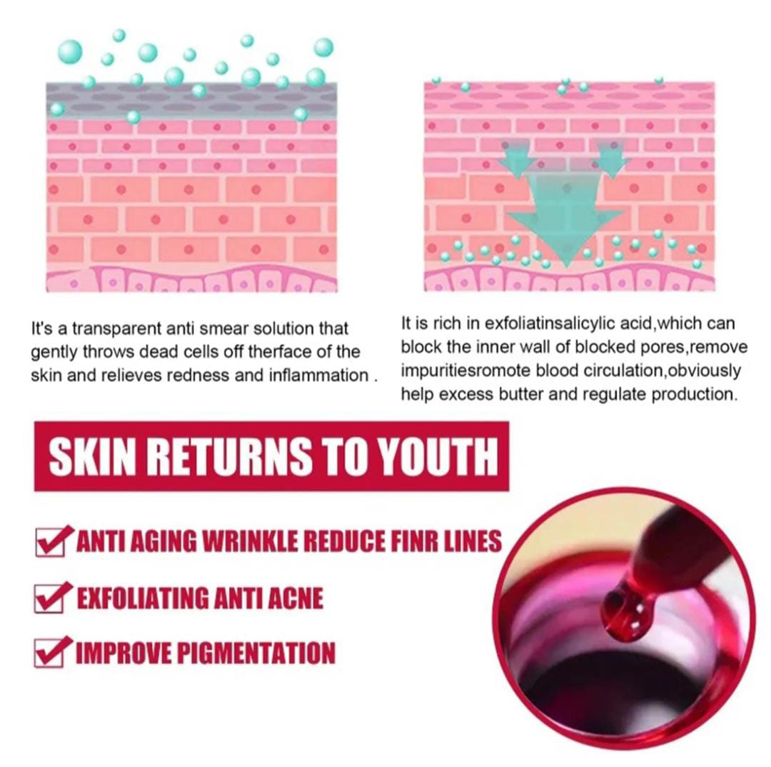 AHA 30% + BHA 2% Peeling Solution 30ml/1oz, Exfoliating Facial Serum, Chemical Peel For Face Serum Glycolic Acid